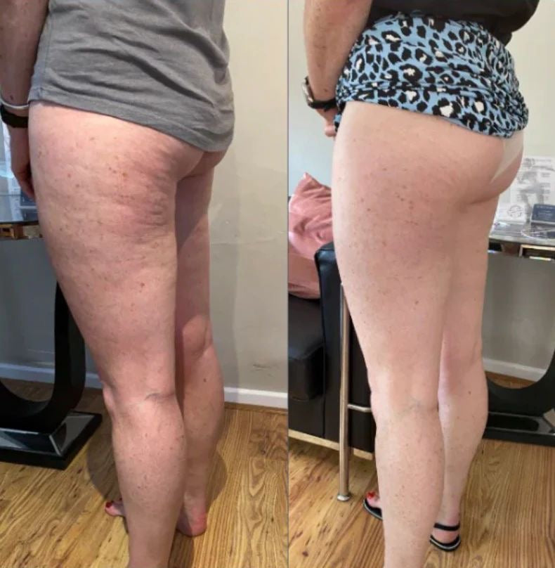 Tightening and firming body cream