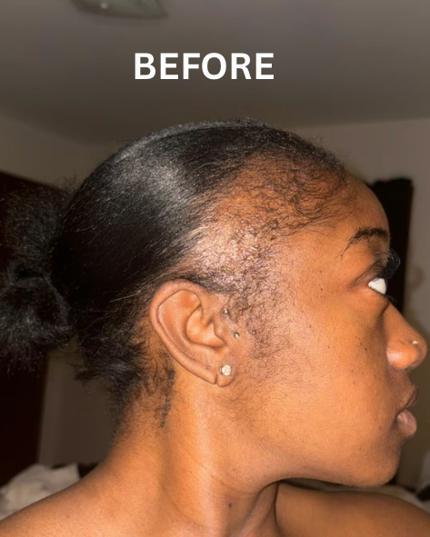 Hairline Growth Oil