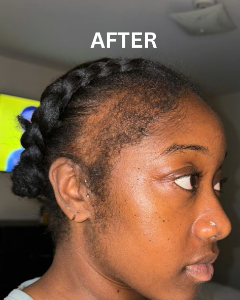 Hairline Growth Oil