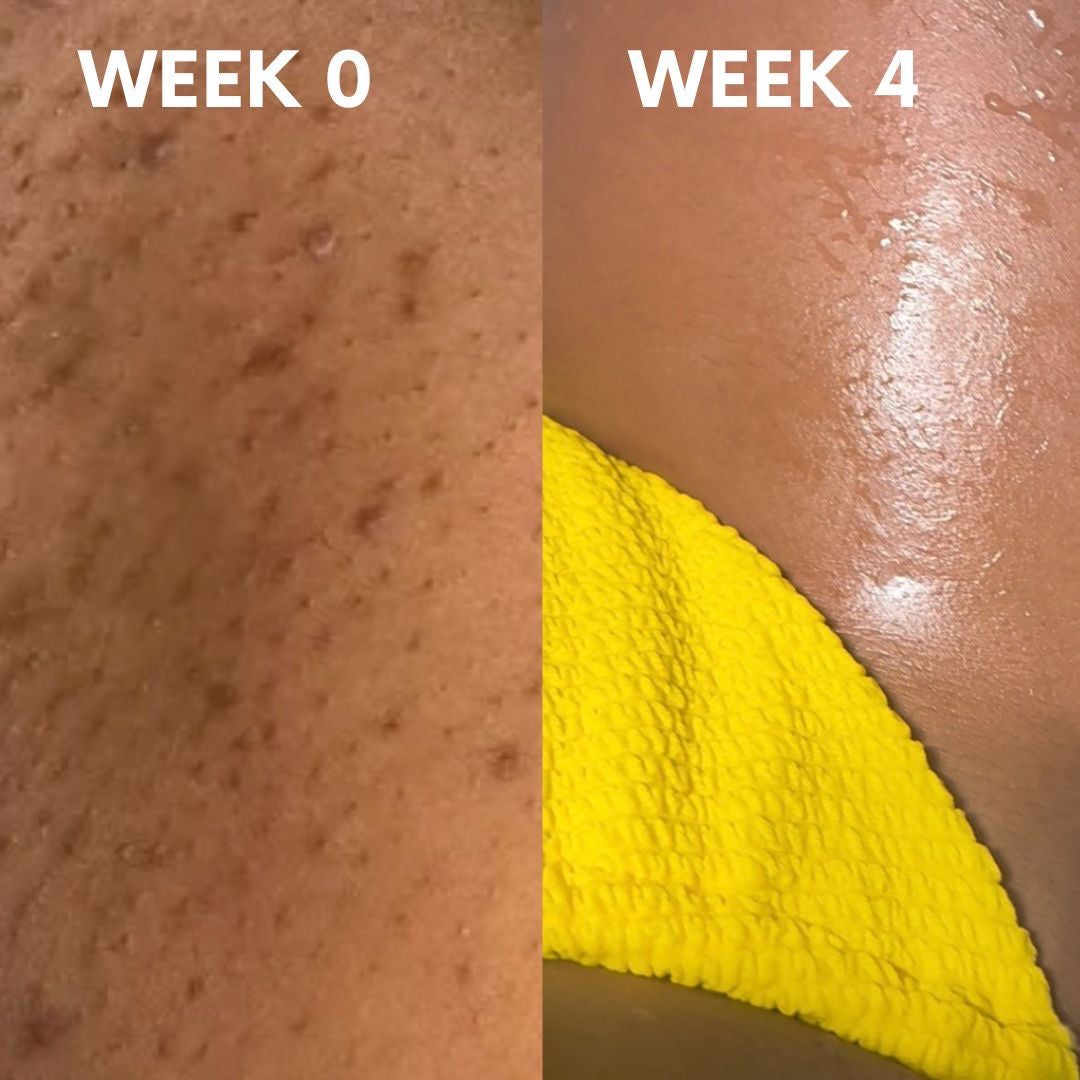 Razor bumps oil